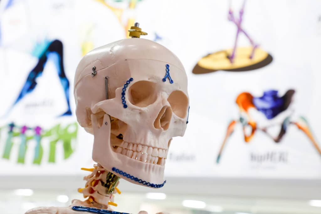 MEDICA 2025: dé ontmoetingsplek voor innovatie in de zorg 2